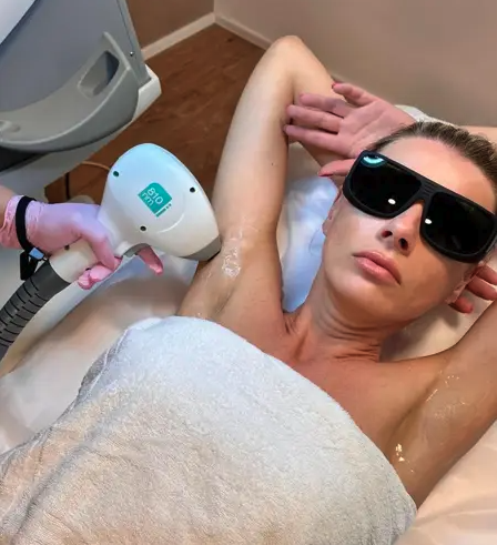Laserová apilácia